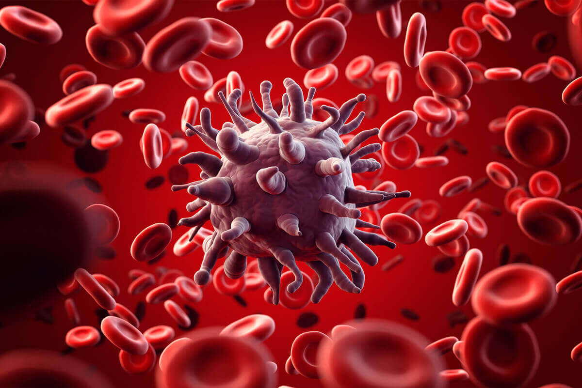 καρκινοσ-του-προστατη-θεραπεια-doctorhomecare