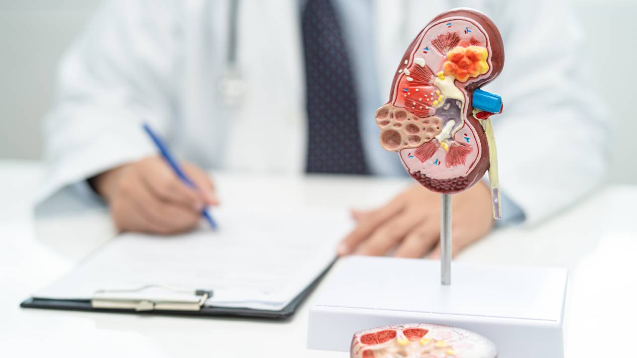 Πονος στα νεφρα. Ανατομικό μοντέλο νεφρού σε ιατρικό περιβάλλον με γιατρό που σημειώνει πληροφορίες στο υπόβαθρο.