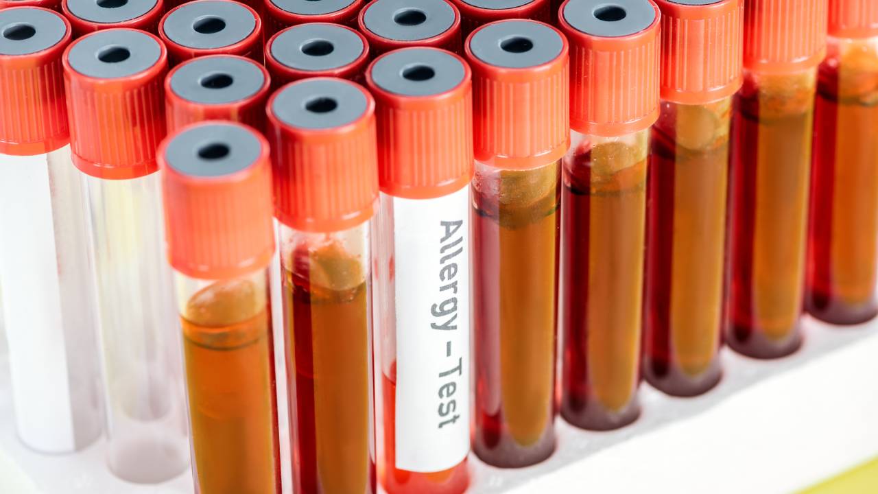 Ανοσολογικές Εξετάσεις Αίματος από την Doctor Home Care