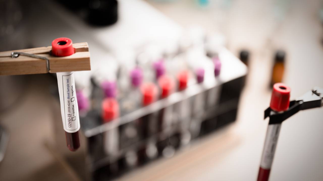 Γενική Αίματος Τι Είναι, Τι Δείχνει Και Προετοιμασία