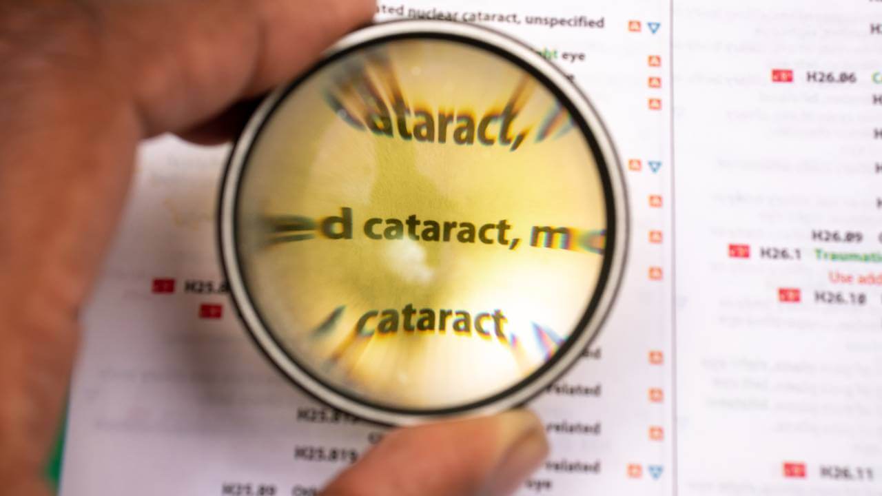 Καταρράκτης Ματιών: Συμπτώματα-Θεραπεία - Doctor Home Care