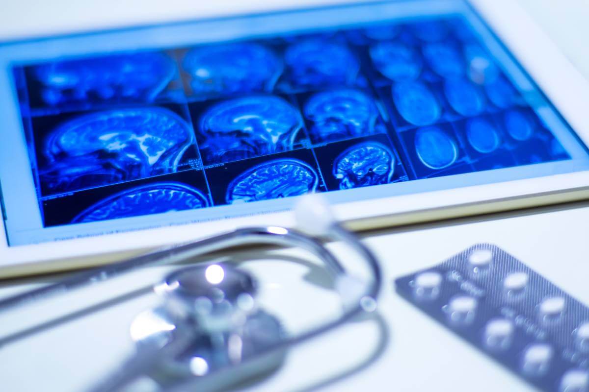 Αιμορραγικό Εγκεφαλικό: Συμπτώματα και Αντιμετώπιση