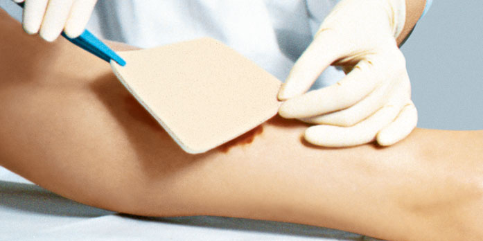 περιποίηση-κατακλίσεων-doctorhomecare